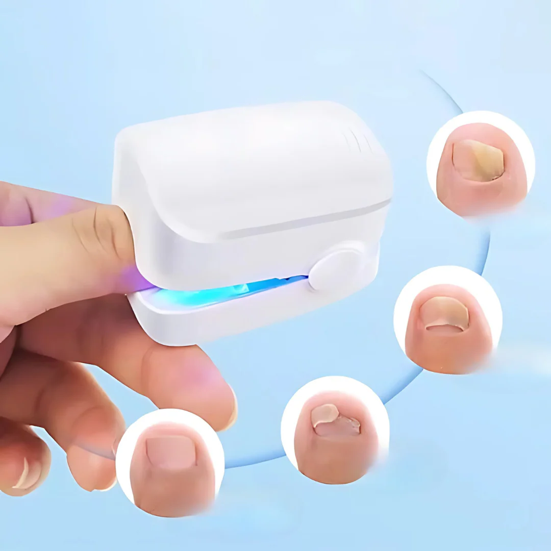 Nail Treatment Laser Device for Fungal Care - Image 7